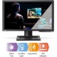 BenQ ZOWIE XL2546 24.5 Inch 240Hz Gaming Monitor 1080P 1ms